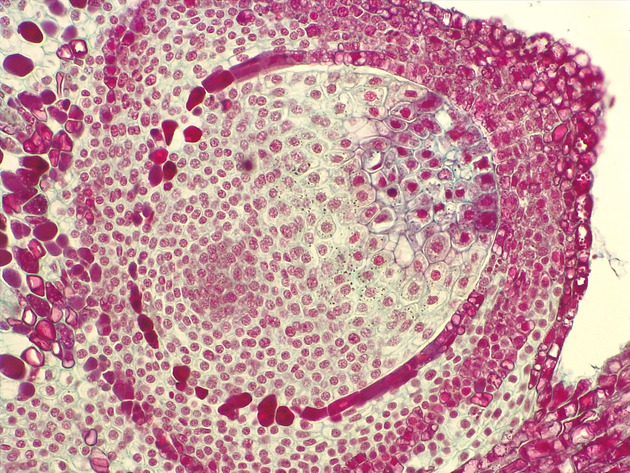 Female Pine Ovule Slides - Female Pine Ovule 01 400X